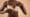 Aesthetic Breast Surgery
