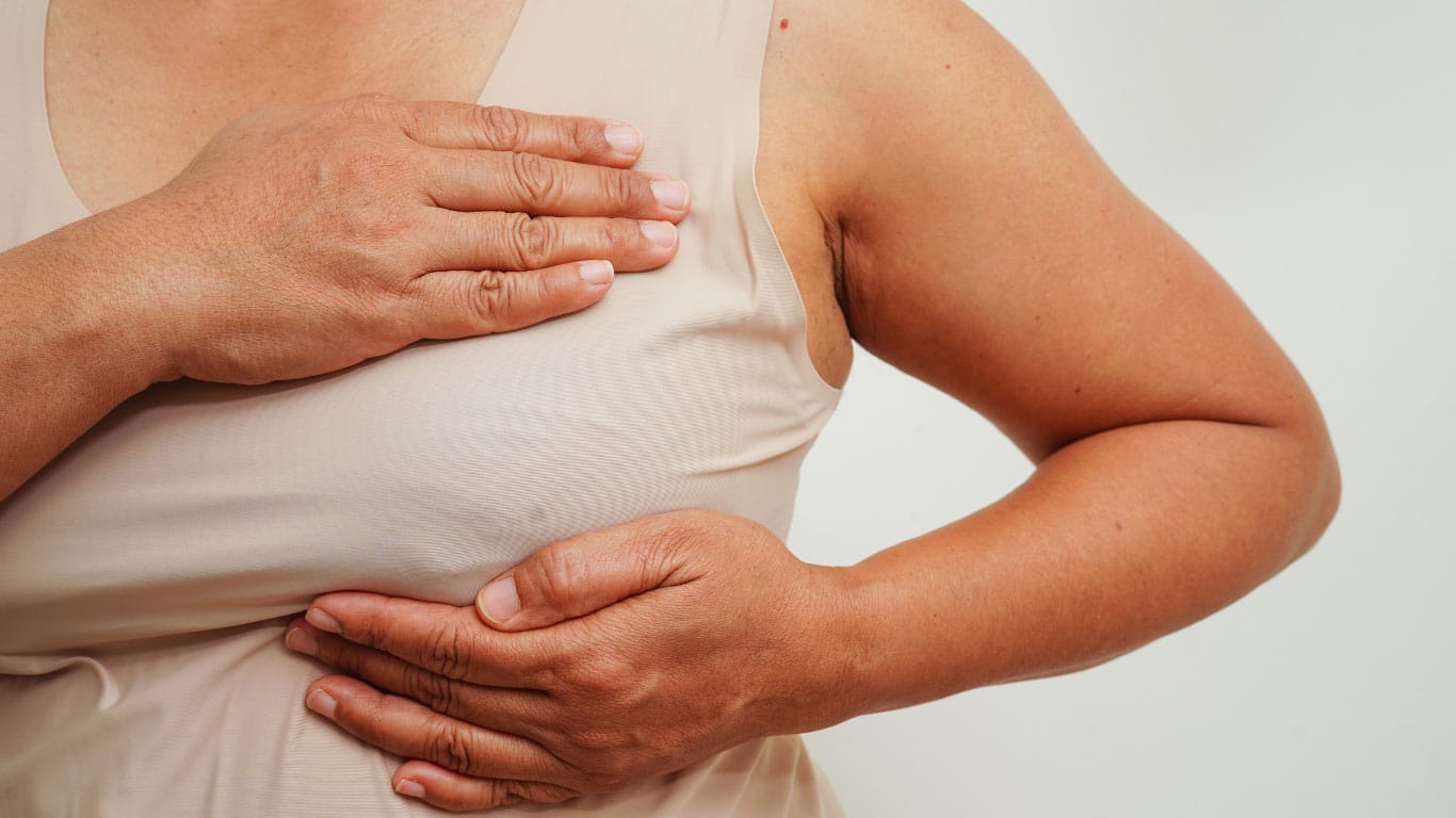 Improving Prior Breast Reconstruction