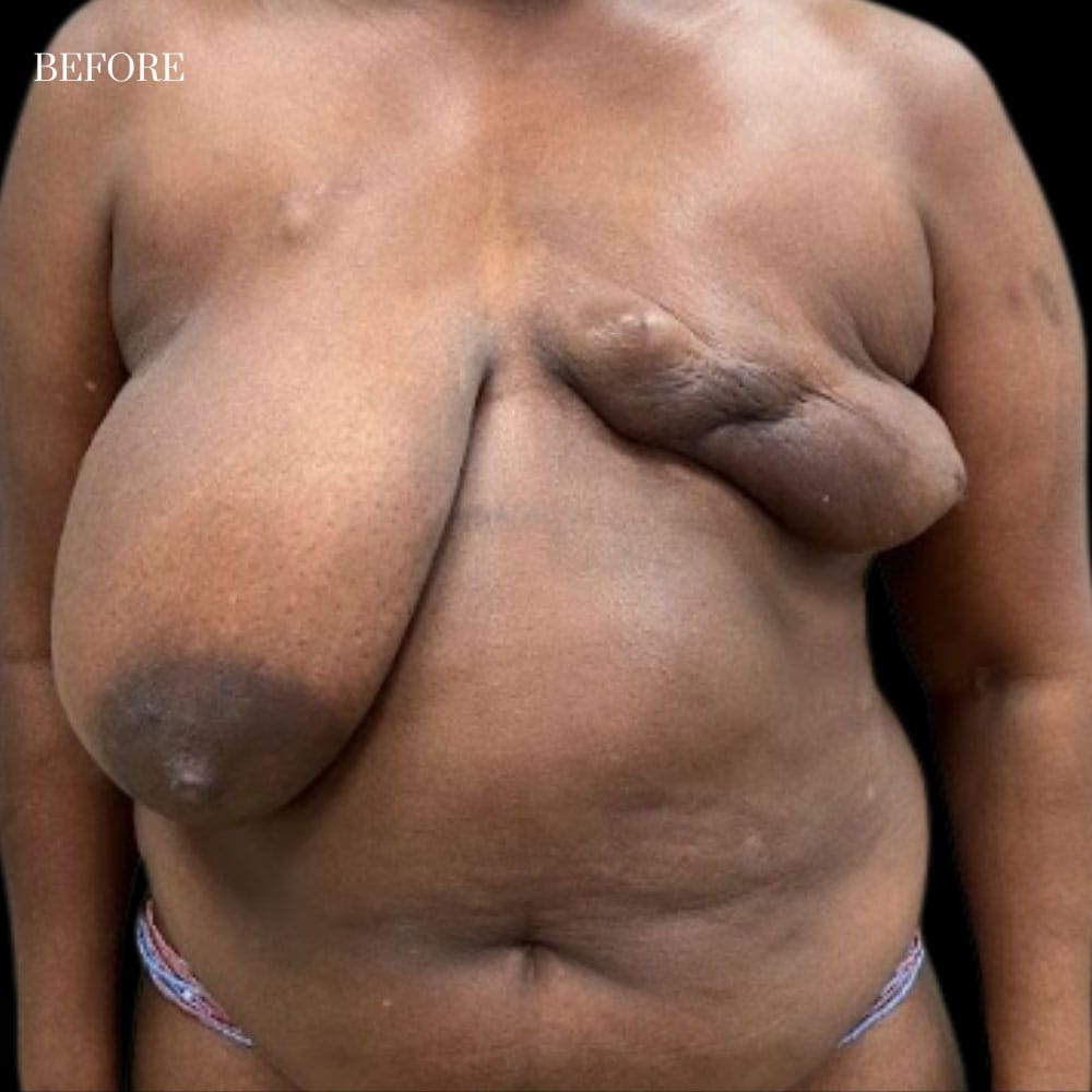 Delayed Reconstruction Case 2.1 Before