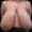 Pre-surgery image of patient with discomfort from large breast size.