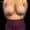 Patient with heavy, pendulous breasts seeking breast size reduction.