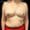 Diep-Flap-Case-2-Before-101