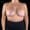 Angled view after breast augmentation highlighting restored volume and contour.
