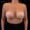 Angled view of patient before breast augmentation showing volume loss.