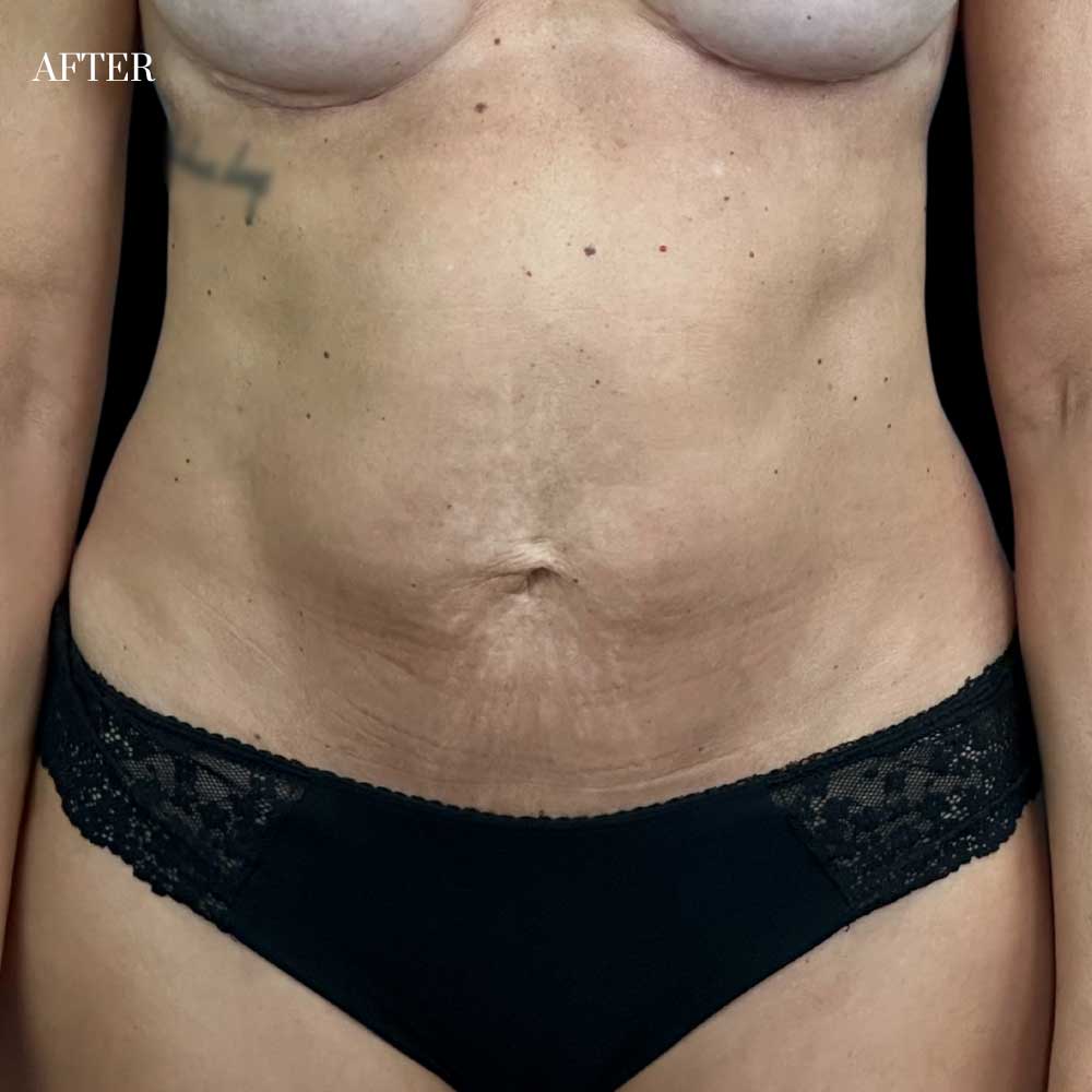 Patient: 45 years old