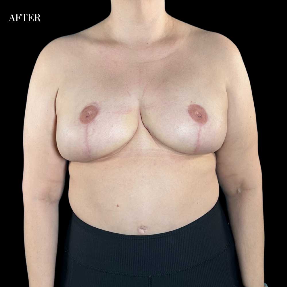 Patient: 38 years old, height: 5’2”, weight: 244 lbs.