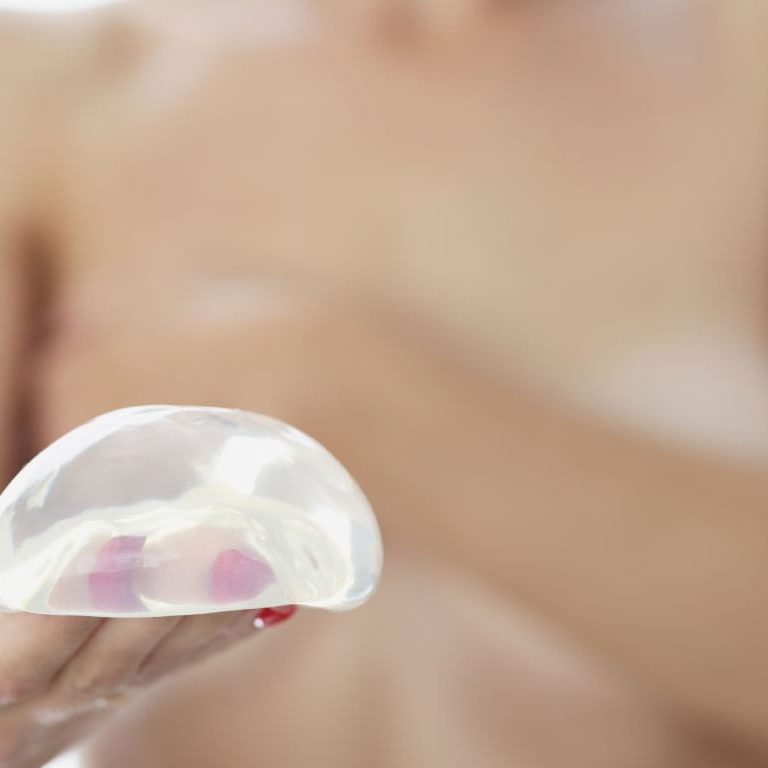 Implant Based Reconstruction